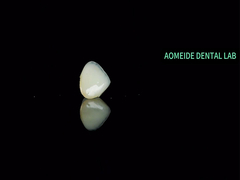 Ceramiczny most koronowy