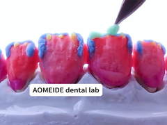 Wytrzymałość Naturalna estetyka Stała korona z cyrkonii Idealnie nadająca się do pojedynczych lub wielu zębów