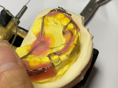 Specjalnie wykonana aparatura ortodontyczna z dobrym utrzymaniem i regulowanymi funkcjami