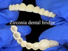 Zirkonia Dental Bridge Silny i naturalny wygląd przywrócenie bezproblemowego uśmiechu