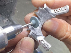 Odlewany częściowy protez