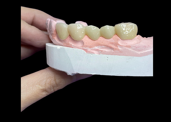 kupować Wszystkie ceramiczne korony i mosty zaprojektowane z myślą o wyższej estetyce, trwałości i naturalnym dopasowaniu do długotrwałej pewności siebie online manufacture