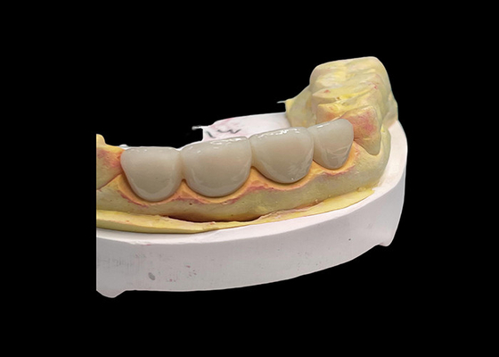 kupować Długotrwały odporny na zużycie Siła cały ceramiczny most koronowy z doskonałą biologiczną kompatybilnością do odbudowy zębów online manufacture