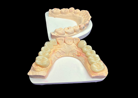 kupować Naturalna estetyka Przezroczyste ceramiczne korony do odnowy zębów z łatwym czyszczeniem i długotrwałymi wynikami online manufacture