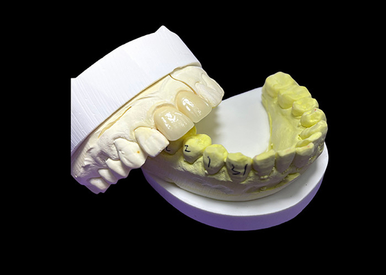 kupować Wytrzymałe, odporne na zużycie, wszystkie ceramiczne korony i mosty dostosowane do potrzeb użytkownika online manufacture