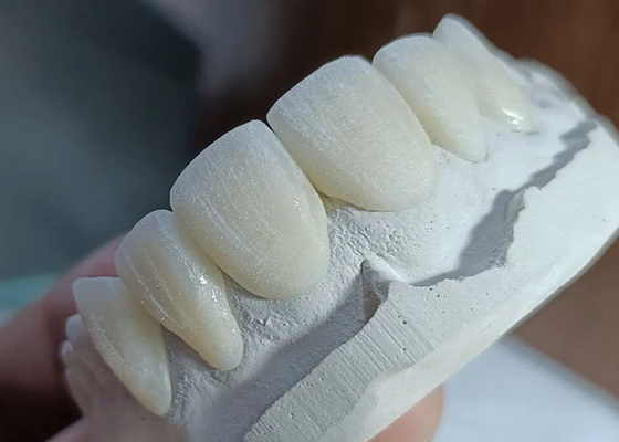 kupować Wzmocniony, odporny na zużycie most z ceramicznej korony dla wygodnej, precyzyjnej restauracji zębów online manufacture
