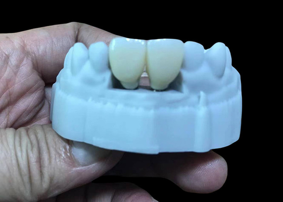 kupować Zastąpić brakujące zęby implantami zębowymi koroną z wkręconą titanową podstawą i cyrkonianą koroną online manufacture