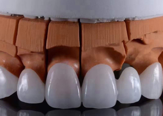 kupować FDA zatwierdziła przezroczyste cyrkoniane korony dentystyczne, precyzyjnie dopasowane do naturalnego wyglądu. online manufacture