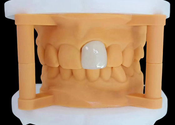 kupować Przejrzystość Zirconia Korona zębowa z estetyczną wydajnością z China Dental Lab online manufacture