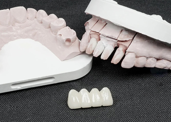 kupować Korony dentystyczne z cyrkonii z najwyższej jakości dla wyższej wytrzymałości i naturalnej estetyki online manufacture