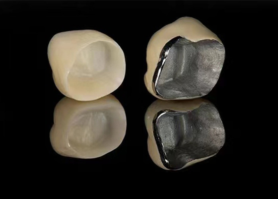 kupować Naturalnie wyglądająca porcelana stopiona do metalowej korony do przywracania uszkodzonych zębów online manufacture