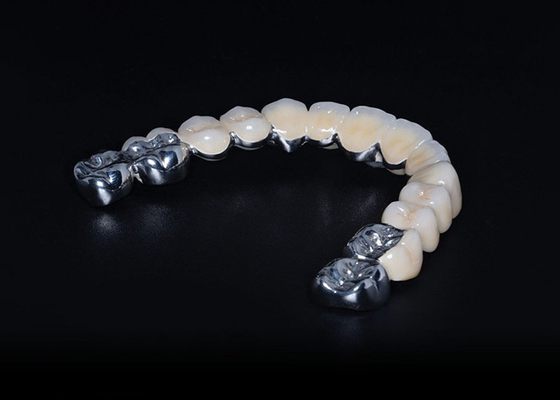 kupować Wysokiej wytrzymałości Biokompatybilna porcelana stopiona do metalowej korony Precyzyjne dopasowanie na zamówienie online manufacture
