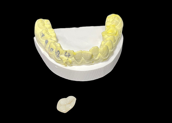 kupować Inlay i Onlay ceramiczne dentystyczne wykonane na zamówienie do rozwiązań regeneracyjnych i naprawy uszkodzonych zębów online manufacture