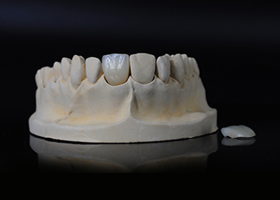kupować Przejrzystość porcelany Emax Veneer dla doskonałego dopasowania / naturalnej estetyki online manufacture