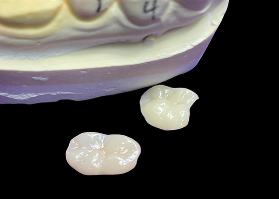 kupować IPS e.max Ceramic Inlays and Onlays for Molar Restoration Naturalna estetyka i wyższa trwałość dla długotrwałych wyników online manufacture