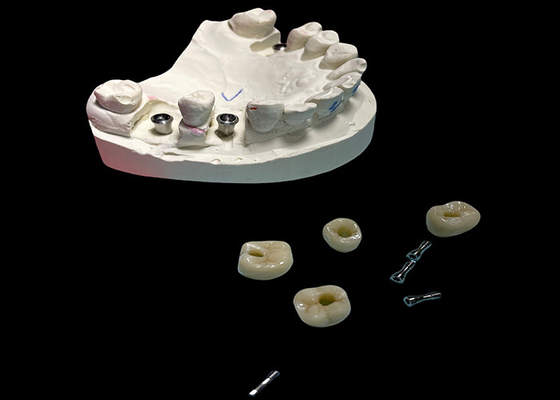 kupować Wypolerowana powierzchnia zębów Implant śrubka Korona utrzymywana do wymiany zębów online manufacture