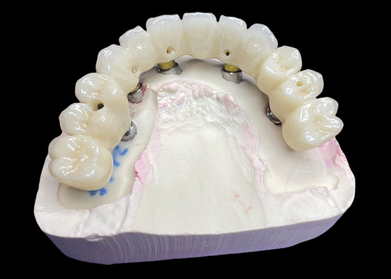 kupować Korony i mosty z implantami zębów o pełnym łuku przywracające funkcje i estetykę dzięki zaawansowanym rozwiązaniom online manufacture
