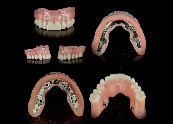 kupować Precyzyjny implant prętowy hybrydowy podtrzymywany bezpieczne dopasowanie regulowana stabilność online manufacture