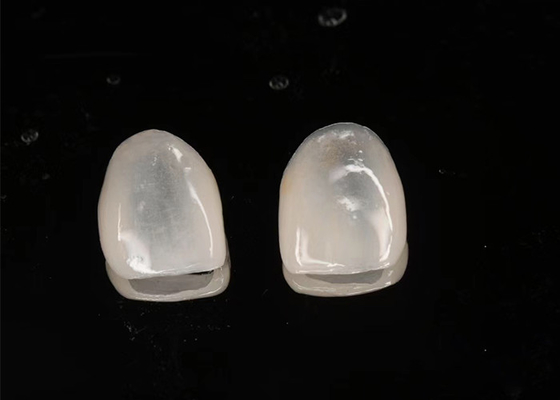 kupować Odbudowa estetyczna Emax Ceramic Veneers Translucency z polerowaną powierzchnią online manufacture