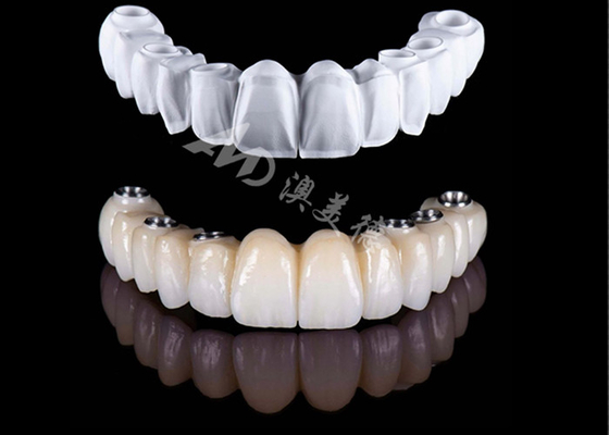 kupować Przystępna cena, precyzyjna, pełna zirkońska korona, wysokiej wytrzymałości zirkońska korona dentystyczna. online manufacture