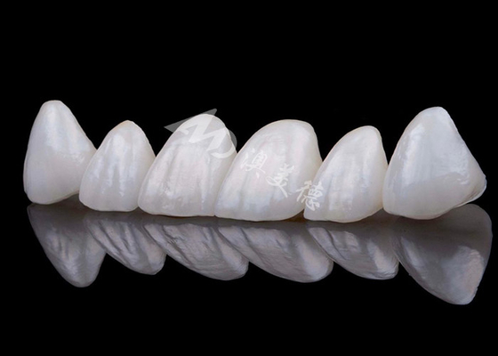 kupować Naturalny wygląd Zirkonia Korona zęba odporność na plamy online manufacture