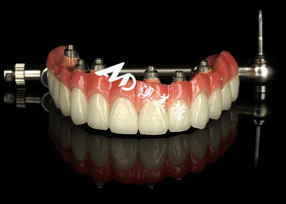 kupować Niestandardowe zęby z implantami, zęby z podłączonymi protezami, mostek koronowy do utrzymania brakujących zębów online manufacture