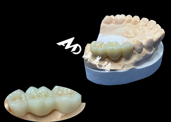 kupować Naturalny kolor Zirconia Korona zębowa odporna na pęknięcia dla bezbłędnego uśmiechu z chińskiego laboratorium stomatologicznego online manufacture