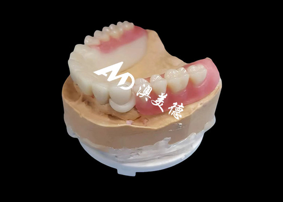 kupować Niestandardowa proteza zębów Hpp Frame Acrylic Removable For Missing Teeth online manufacture