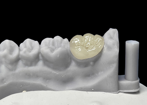 kupować Precyzyjnie dopasowane dentystyczne ceramiczne wkładki, porcelanowe wkładki i wkładki zatwierdzone przez FDA online manufacture