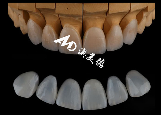 kupować Wysoce precyzyjne składniki Emax/porcelanowe składniki stomatologiczne do stomatologii kosmetycznej online manufacture
