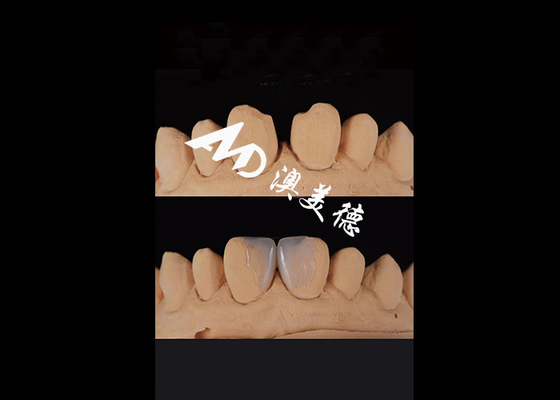 kupować 0.3-0.5mm Ultra Cienkie IPS EMAX Porcelanowe finery do estetycznego makijażu uśmiechu online manufacture