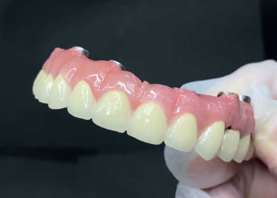 kupować Trwałe implanty dentystyczne z łatwo czyszczonym titaniowym podłożem i cyrkoniową koroną online manufacture