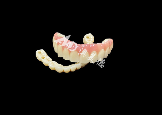kupować Zęby z implantami - ostateczne rozwiązanie dla brakujących zębów online manufacture