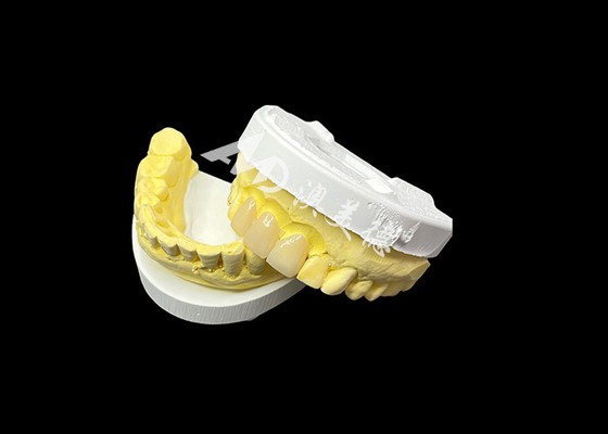kupować Popraw estetykę zębów dzięki ceramicznemu mostkowi koronowemu, który łączy wyjątkową estetykę i wyjątkową kompatybilność biologiczną dla naturalnego, komfortowego uśmiechu online manufacture