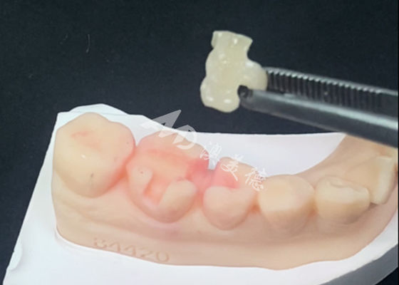 kupować Wkłady i nakłady ceramiczne Emax - odbudowy stomatologiczne dla naturalnego koloru zęba online manufacture