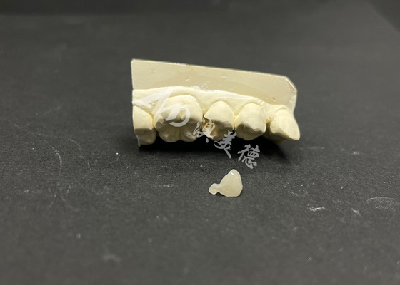 kupować Hipoalergiczna, odporna na plamy, ceramiczna wkładka Emax do dokładnej naprawy uszkodzonych zębów online manufacture