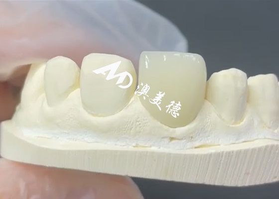 kupować Trwałe i estetyczne finery EMAX doskonałe rozwiązanie dla restauracji porcelany online manufacture