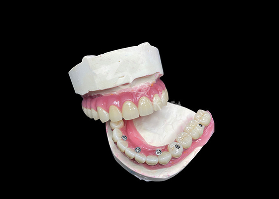 kupować Zirkoński implant zębowy, most koronowy na szóstym piętrze, na zamianę brakującego zęba. online manufacture