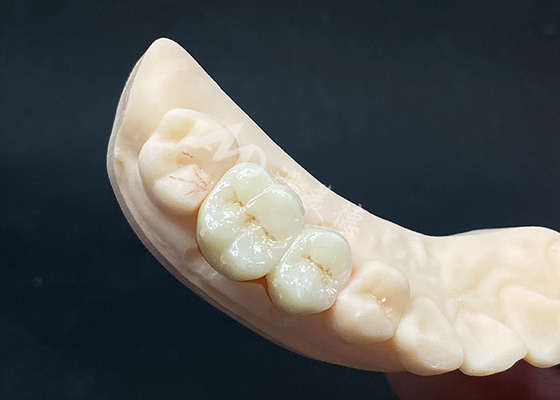 kupować Wysokiej przejrzystości Zirconia Crown Naturalny wygląd Design z odpornością na szczelinowanie online manufacture