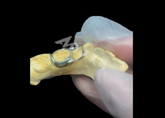 kupować Ortodontyczny utrzymujący przestrzeń to nieocenione urządzenie genialnie chroniące dziury zębów dzieci, zapewniające prawidłowy rozwój zębów. online manufacture