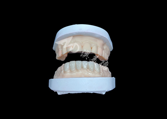 kupować IPS Emax Veneers Naturalny wygląd Restauracje dla estetycznego uśmiechu online manufacture