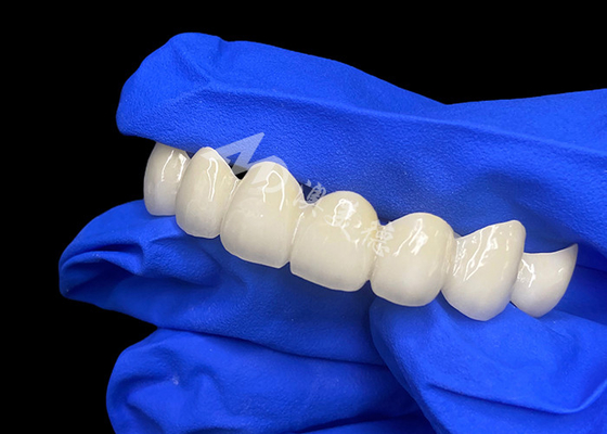 kupować Wysokiej przejrzystości Lawy Zirkonia Dental Bridge Bezszwedzą mieszankę z naturalnymi zębami online manufacture