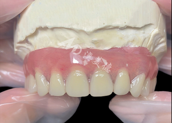 kupować Implant z tytanu wspierany Bar Attachment Zęby z chińskiego laboratorium stomatologicznego online manufacture