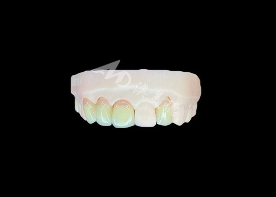 kupować Naturalny i komfortowy Fit Zirconia Porcelana Korona China Dental Lab Dostosowywalny Cienie online manufacture