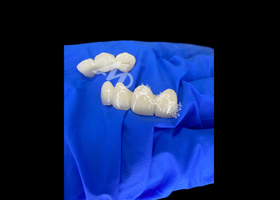 kupować Wieland Zenostar Ceramic Crown Bridge Wysoka precyzja dla trwałych i naturalnie wyglądających restauracji online manufacture