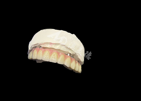 kupować Zęby z implantami Stabilność Komfort i naturalny uśmiech online manufacture
