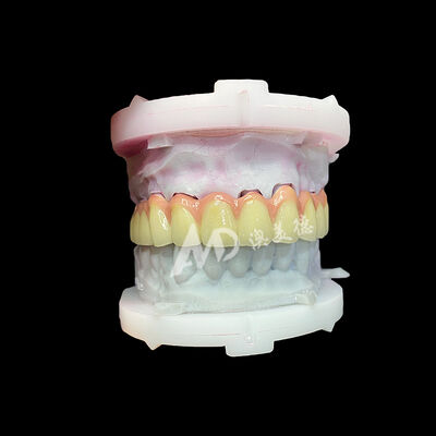 kupować Korona i most ceramiczny z czystego tytanu Trwałe, lekkie i estetyczne odbudowy online manufacture