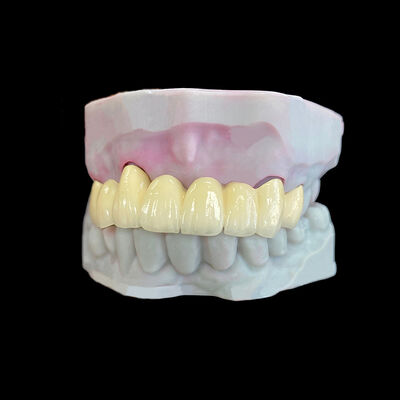 kupować Korona porcelanowa na metalu (PFM) z podbudową Co-Cr online manufacture