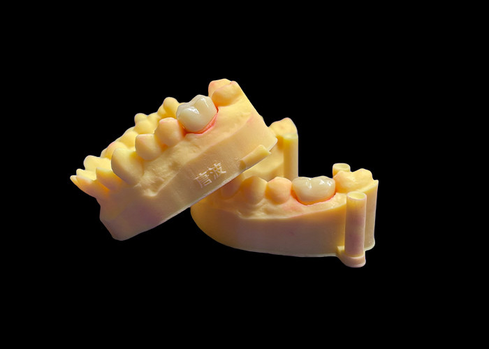 Wysokiej klasy cyrkonium porcelanowe korony dentystyczne Bezkonkurencyjna wytrzymałość Precyzja dopasowanie i wyjątkowa estetyka i trwałość