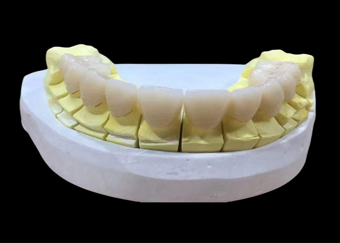 Zirconia porcelana Korona zębowa z estetycznym i naturalnie wyglądającym wykończeniem z chińskiego laboratorium stomatologicznego